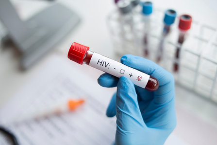 HIV positive test