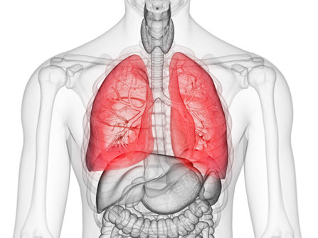 Affected lungs